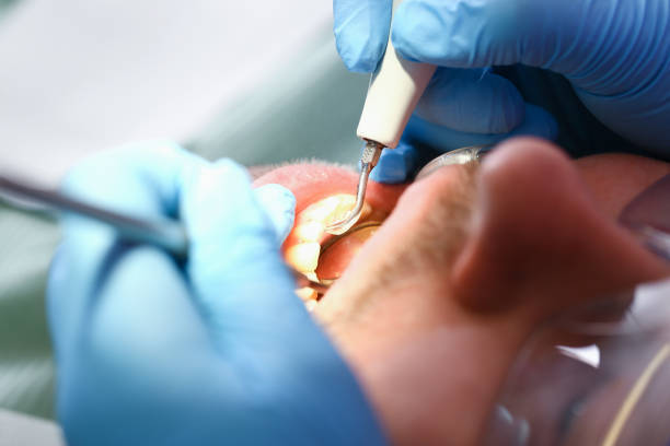 Best Pediatric Emergency Dentist in Red Bluff, CA